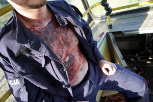 ujęcie na obrażenia ciała osób pozorujących poszkodowanych w tramwaju
